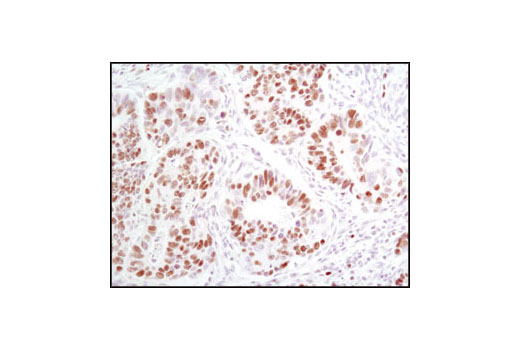 Immunohistochemistry Image 2: MCM2 (D7G11) XP® Rabbit mAb (BSA and Azide Free)