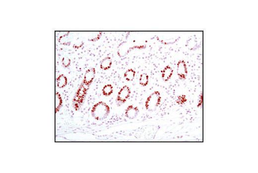 Immunohistochemistry Image 1: MCM2 (D7G11) XP® Rabbit mAb (BSA and Azide Free)
