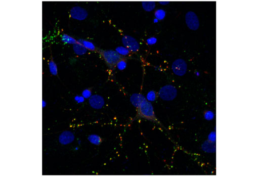 Immunofluorescence Image 1: PSD95 (7E3) Mouse mAb