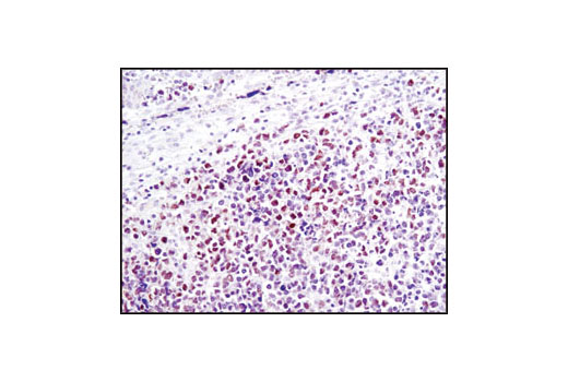 Immunohistochemistry Image 1: NUT (C52B1) Rabbit mAb