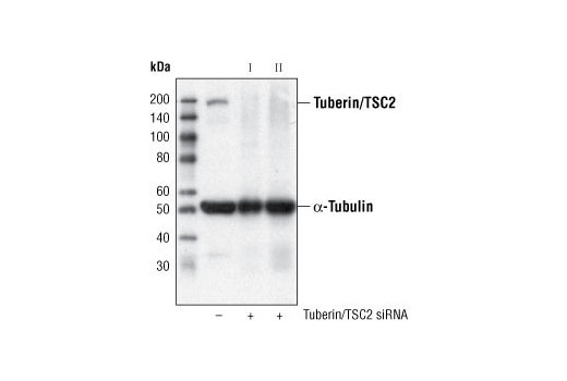 Western Blotting Image 2: Tuberin/TSC2 (28A7) Rabbit mAb
