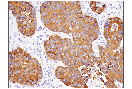 Immunohistochemistry Image 4: Synaptophysin (D8F6H) XP® Rabbit mAb