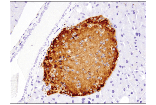 Immunohistochemistry Image 6: Synaptophysin (D8F6H) XP® Rabbit mAb