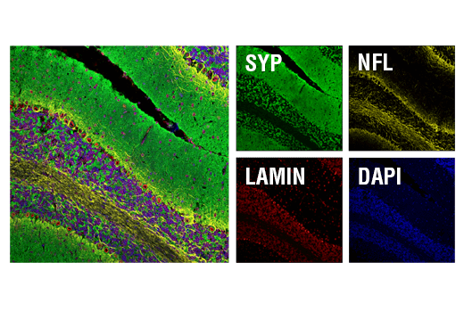 Immunofluorescence Image 2: Synaptophysin (D8F6H) XP® Rabbit mAb