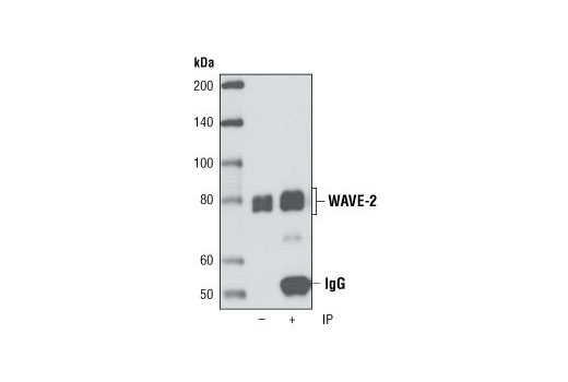 Immunoprecipitation Image 1: WAVE-2 (D2C8) XP® Rabbit mAb