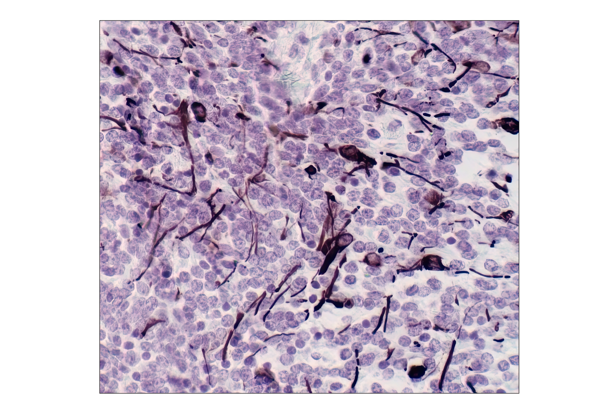  Image 7: Neuronal Marker IF Antibody Sampler Kit II
