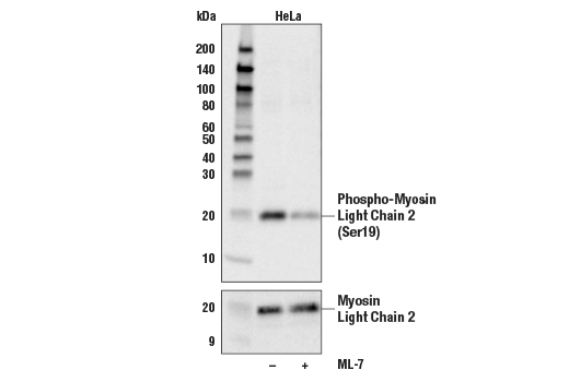 Western Blotting Image 1: Phospho-Myosin Light Chain 2 (Ser19) Antibody
