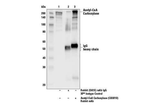  Image 8: Acetyl-CoA Carboxylase 1 and 2 Antibody Sampler Kit