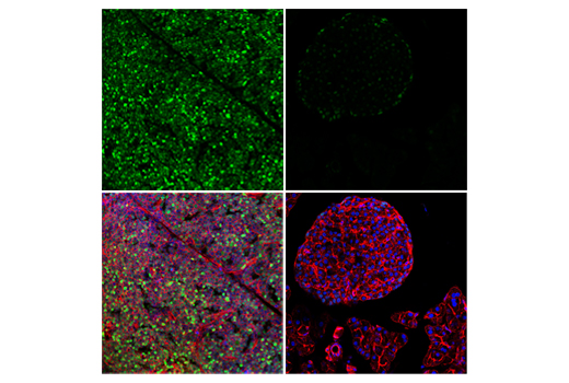 Immunofluorescence Image 1: Tox/Tox2 (E6G5O) Rabbit mAb