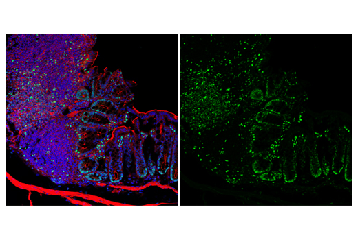 Immunofluorescence Image 3: Tox/Tox2 (E6G5O) Rabbit mAb