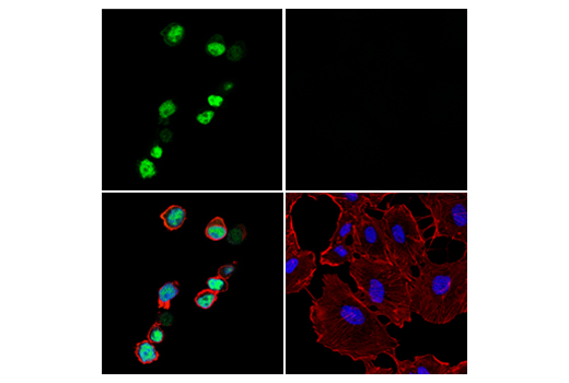 Immunofluorescence Image 4: Tox/Tox2 (E6G5O) Rabbit mAb