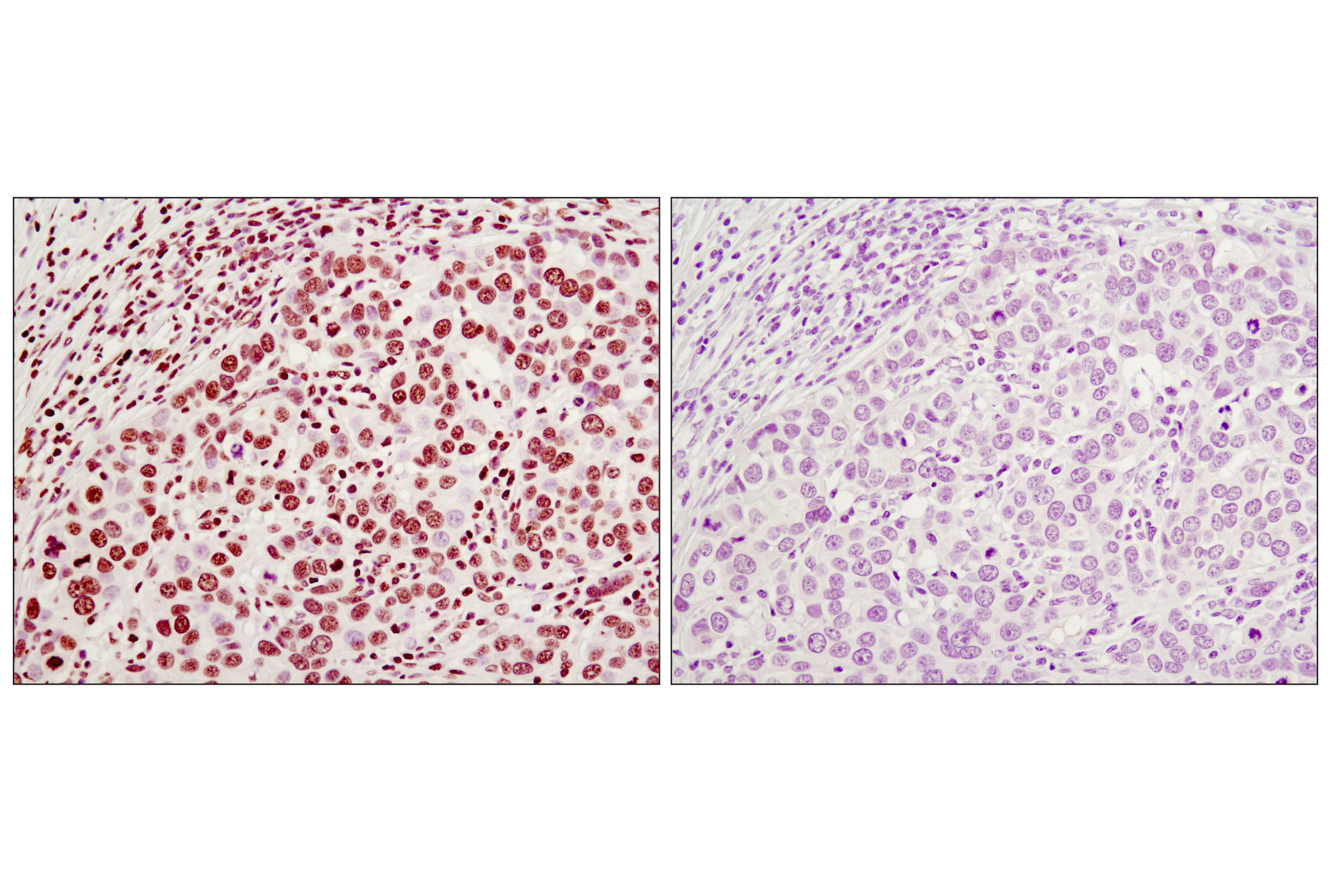 Immunohistochemistry Image 2: Histone H3 (96C10) Mouse mAb (IHC Formulated)