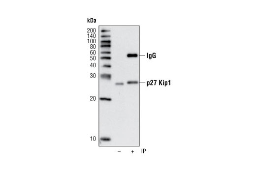  Image 24: Cell Cycle Regulation Antibody Sampler Kit