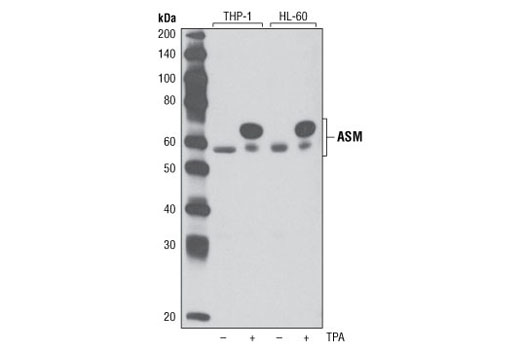 Western Blotting Image 1: ASM Antibody