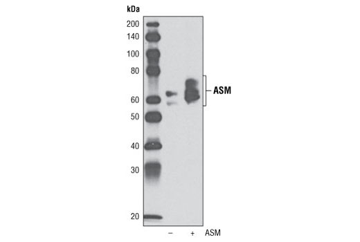 Western Blotting Image 2: ASM Antibody