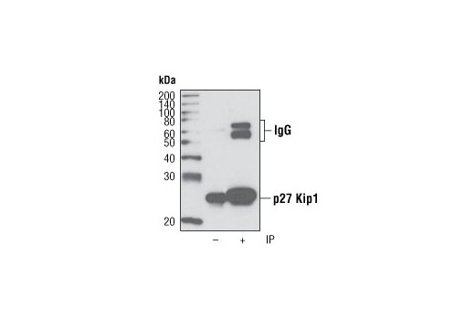 Immunoprecipitation Image 1: p27 Kip1 (D37H1) Rabbit mAb
