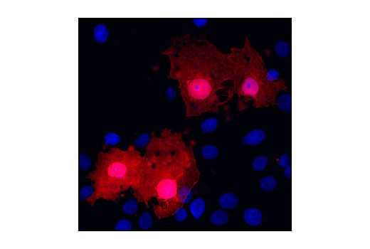 Immunofluorescence Image 1: GST (26H1) Mouse mAb (Alexa Fluor® 555 Conjugate)