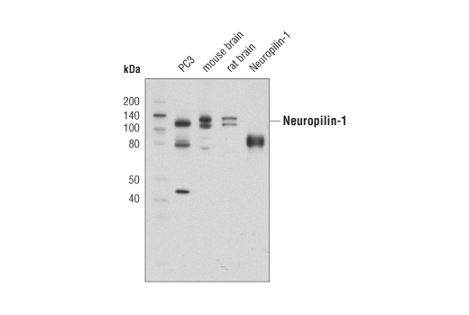 Western Blotting Image 1: Neuropilin-1 (D62C6) Rabbit mAb