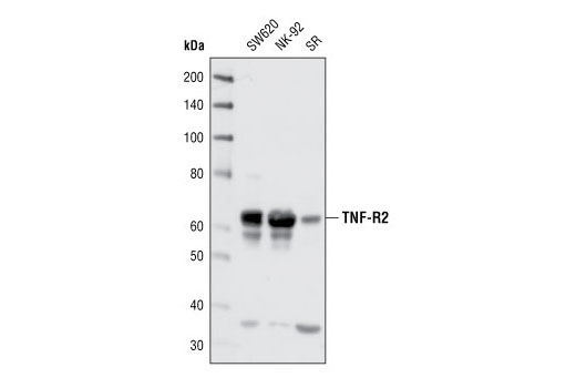 Western Blotting Image 1: TNF-R2 Antibody