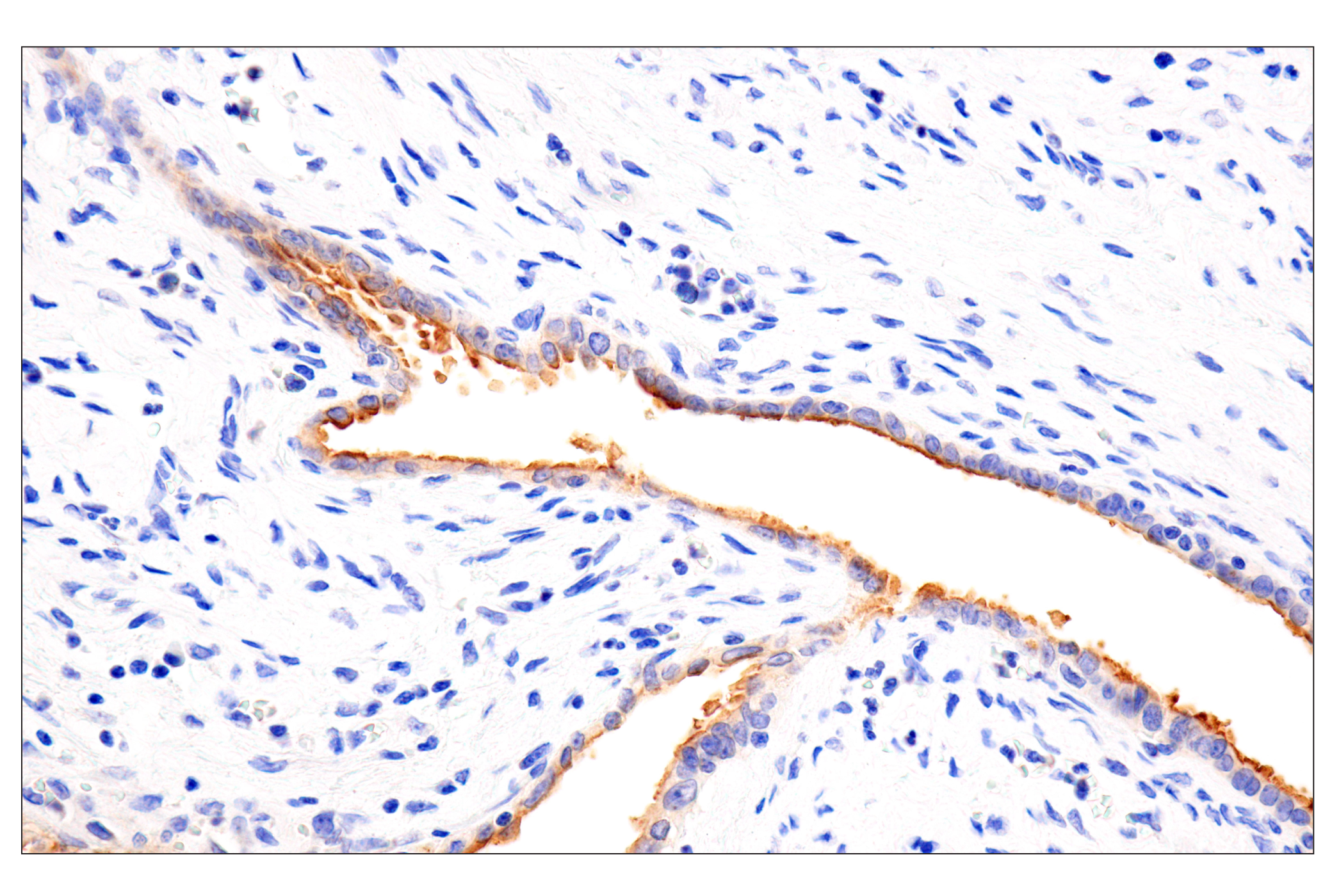 Immunohistochemistry Image 6: Folate Receptor Alpha/FOLR1 (BN3.2) Mouse mAb
