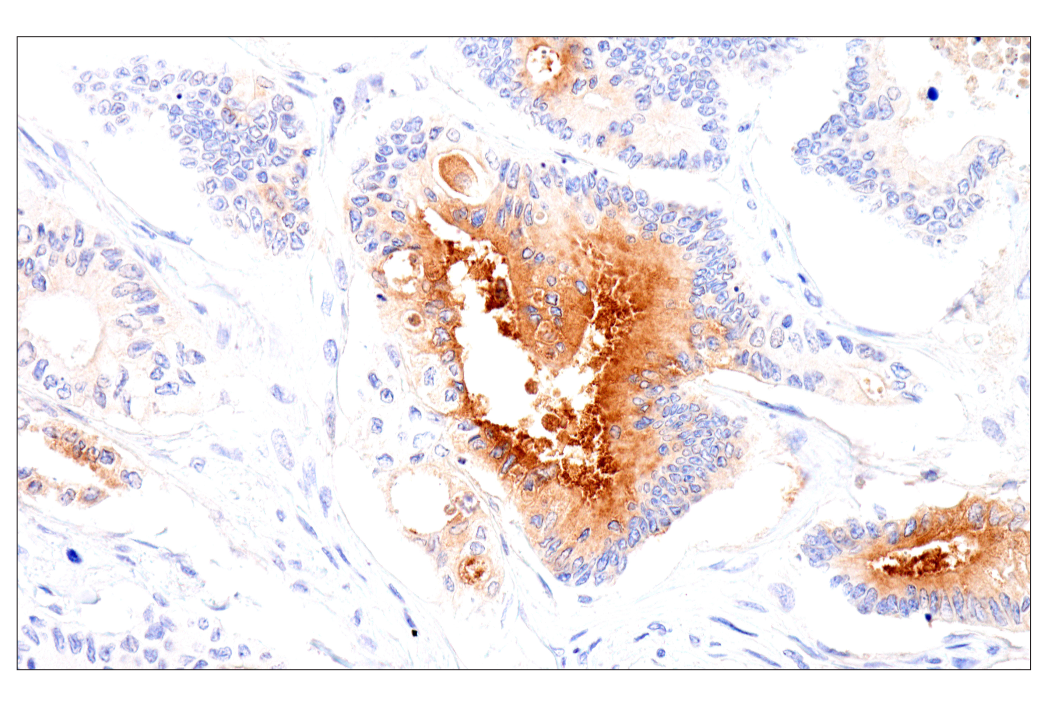 Immunohistochemistry Image 10: Folate Receptor Alpha/FOLR1 (BN3.2) Mouse mAb