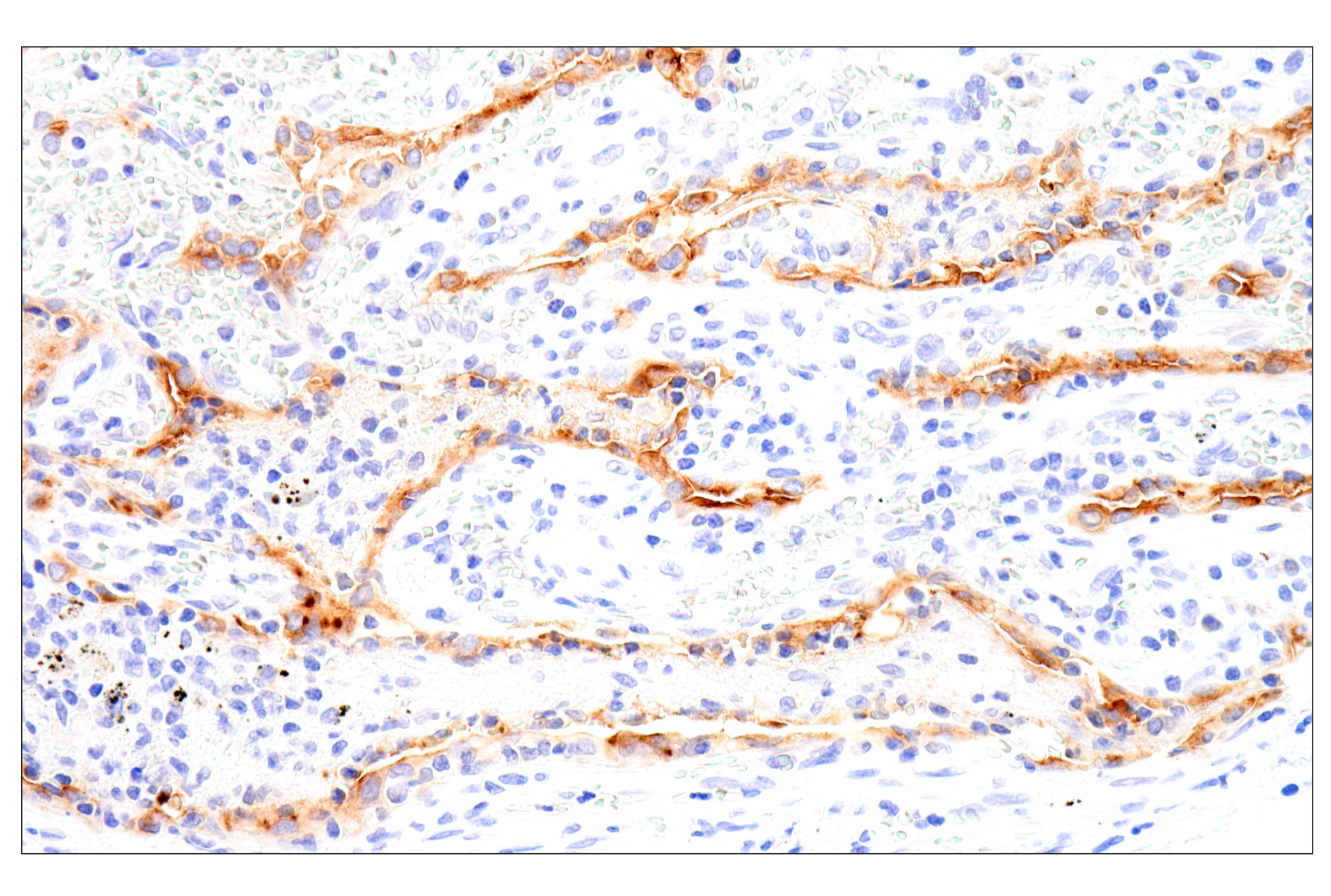 Immunohistochemistry Image 9: Folate Receptor Alpha/FOLR1 (BN3.2) Mouse mAb