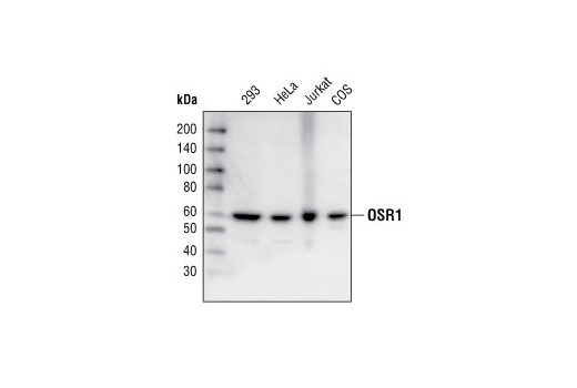 Western Blotting Image 1: OSR1 Antibody