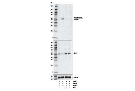  Image 1: PhosphoPlus® MLKL (Ser345) Antibody Duet