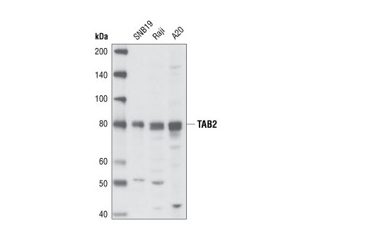 Western Blotting Image 1: TAB2 Antibody