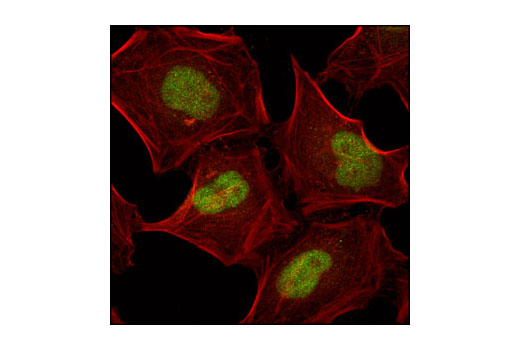 Immunofluorescence Image 1: JunB (G53) Antibody