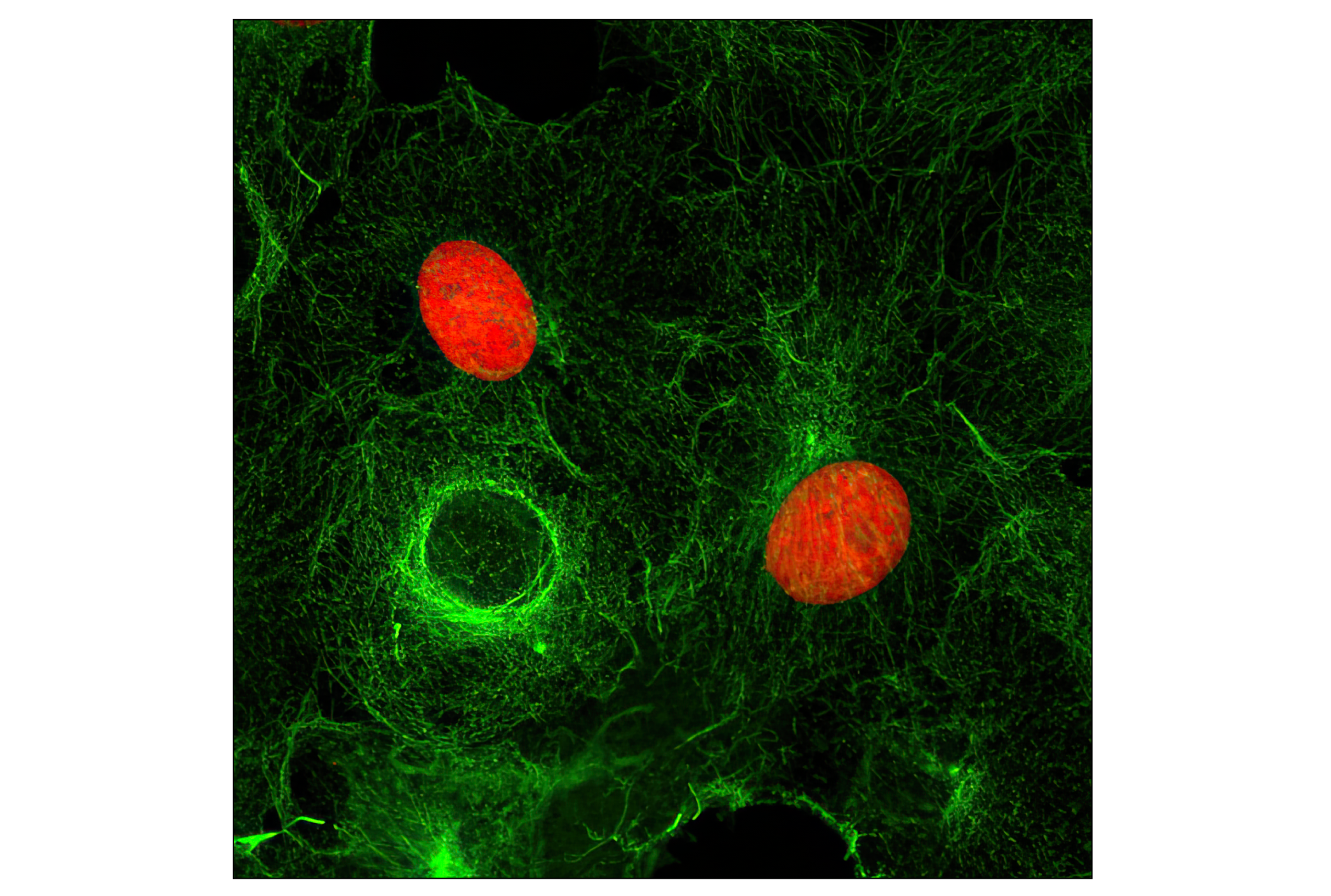 Immunofluorescence Image 1: Myc-Tag (9B11) Mouse mAb (Alexa Fluor® 555 Conjugate)