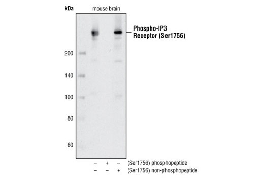 Western Blotting Image 1: Phospho-IP3 Receptor (Ser1756) Antibody
