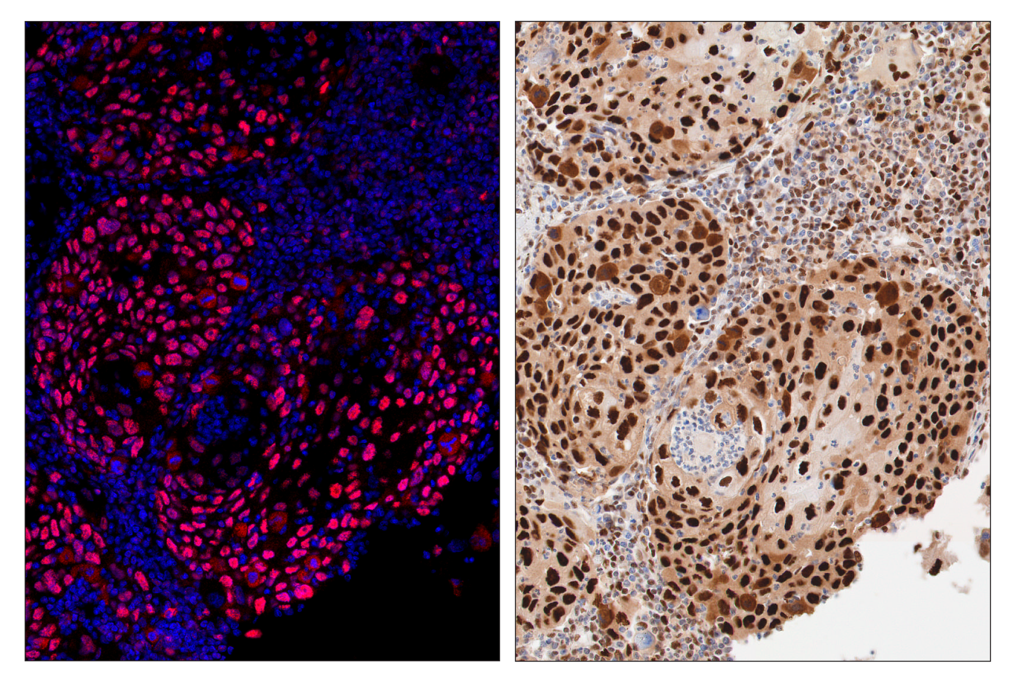 Immunohistochemistry Image 4: PCNA (D3H8P) & CO-0090-594 SignalStar™ Oligo-Antibody Pair
