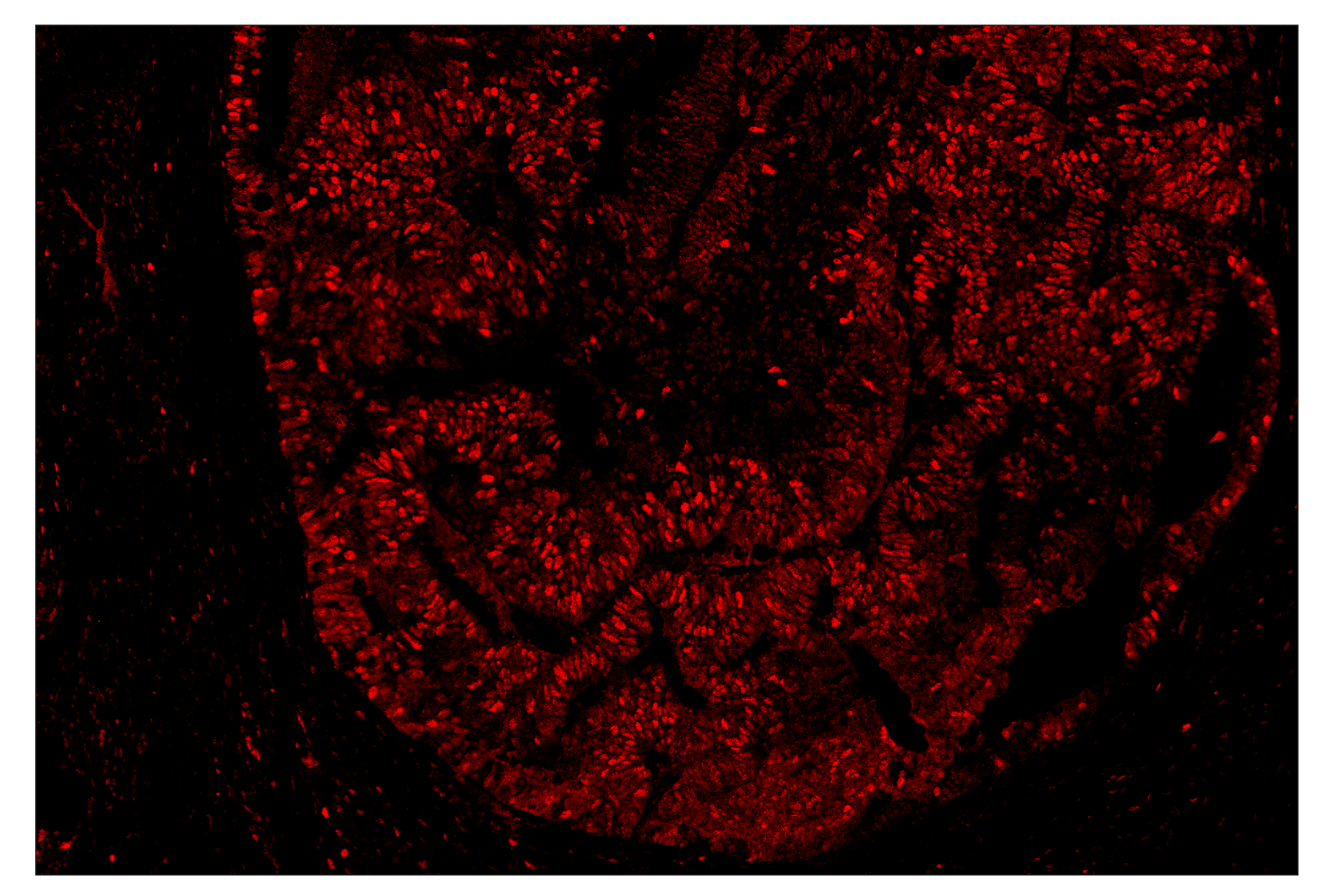 Immunohistochemistry Image 6: PCNA (D3H8P) & CO-0090-488 SignalStar™ Oligo-Antibody Pair
