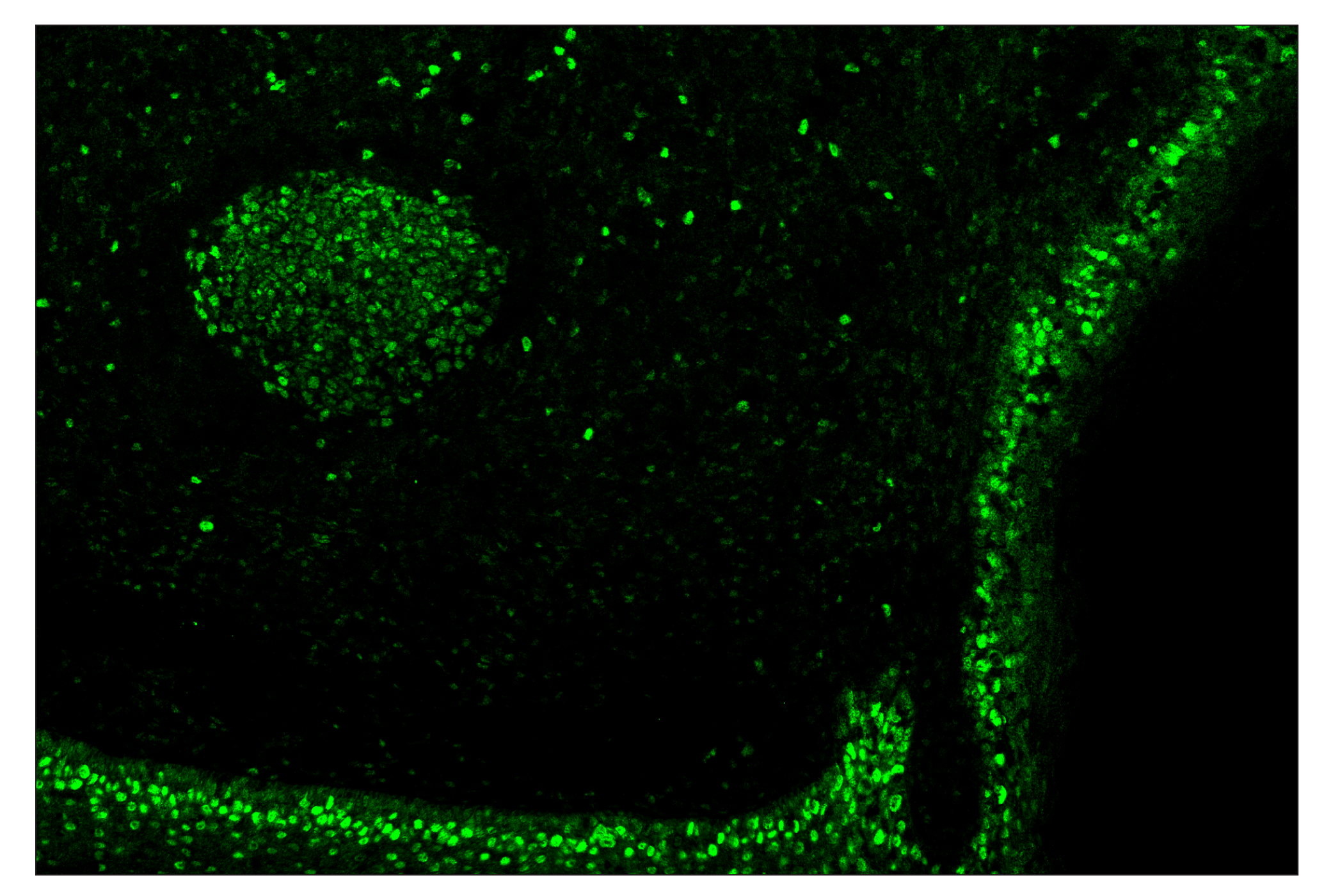 Immunohistochemistry Image 2: PCNA (D3H8P) & CO-0090-488 SignalStar™ Oligo-Antibody Pair