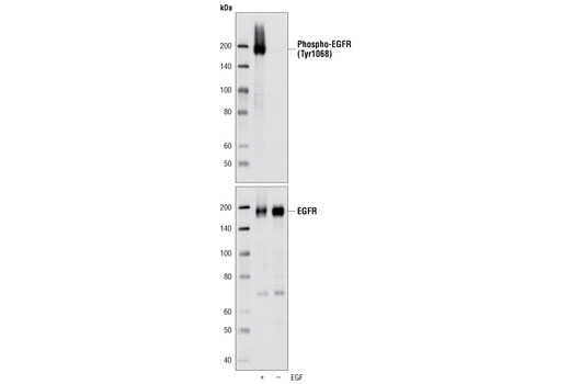  Image 5: Phospho-EGF Receptor Antibody Sampler Kit