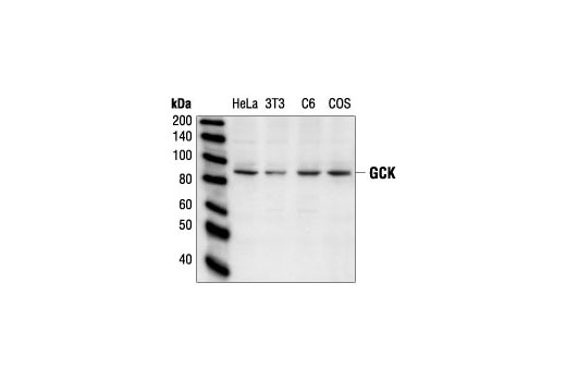 Western Blotting Image 1: GCK Antibody