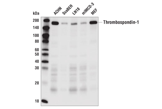 Western Blotting Image 1: Thrombospondin-1 (D7E5F) Rabbit mAb