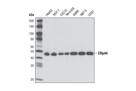  Image 7: ER Protein Folding Antibody Sampler Kit