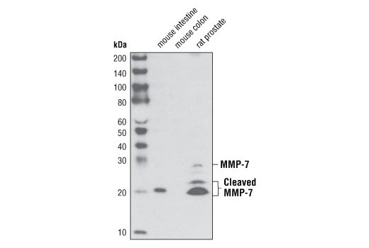 Western Blotting Image 1: MMP-7 (D4H5) XP® Rabbit mAb