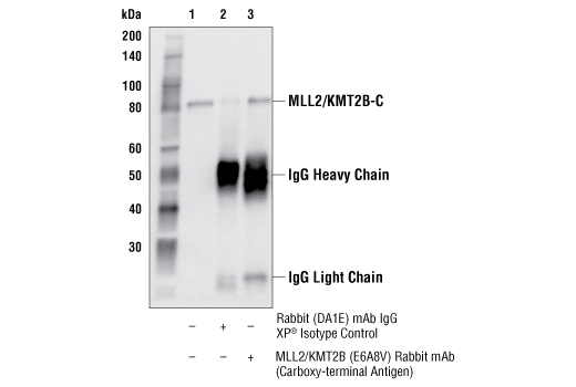 Immunoprecipitation Image 1: MLL2/KMT2B (E6A8V) Rabbit mAb (Carboxy-terminal Antigen)