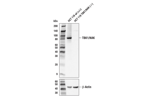  Image 1: PhosphoPlus® TBK1/NAK (Ser172) Antibody Duet
