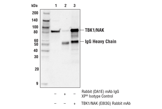 Immunoprecipitation Image 1: TBK1/NAK (E8I3G) Rabbit mAb