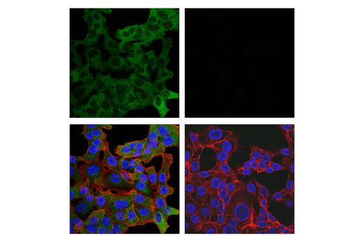 Immunofluorescence Image 1: TBK1/NAK (E8I3G) Rabbit mAb
