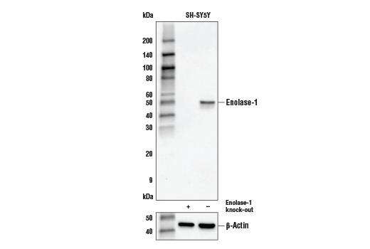  Image 4: Glycolysis II Antibody Sampler Kit