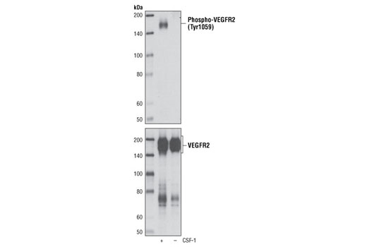 Western Blotting Image 1: Phospho-VEGF Receptor 2 (Tyr1059) (D5A6) Rabbit mAb