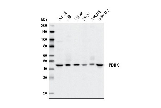 Western Blotting Image 1: PDHK1 (C47H1) Rabbit mAb