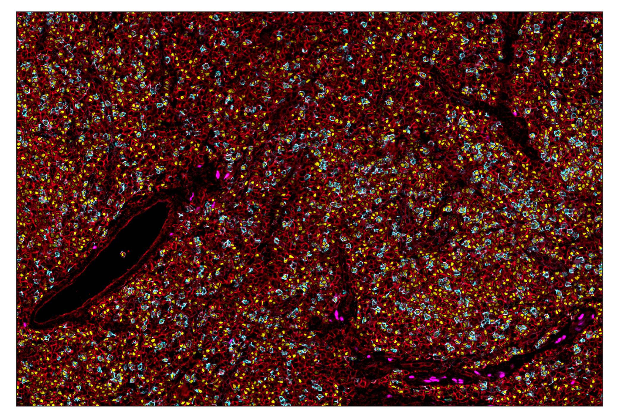 Immunohistochemistry Image 7: Sox10 (E6B6I) & CO-0080-594 SignalStar™ Oligo-Antibody Pair