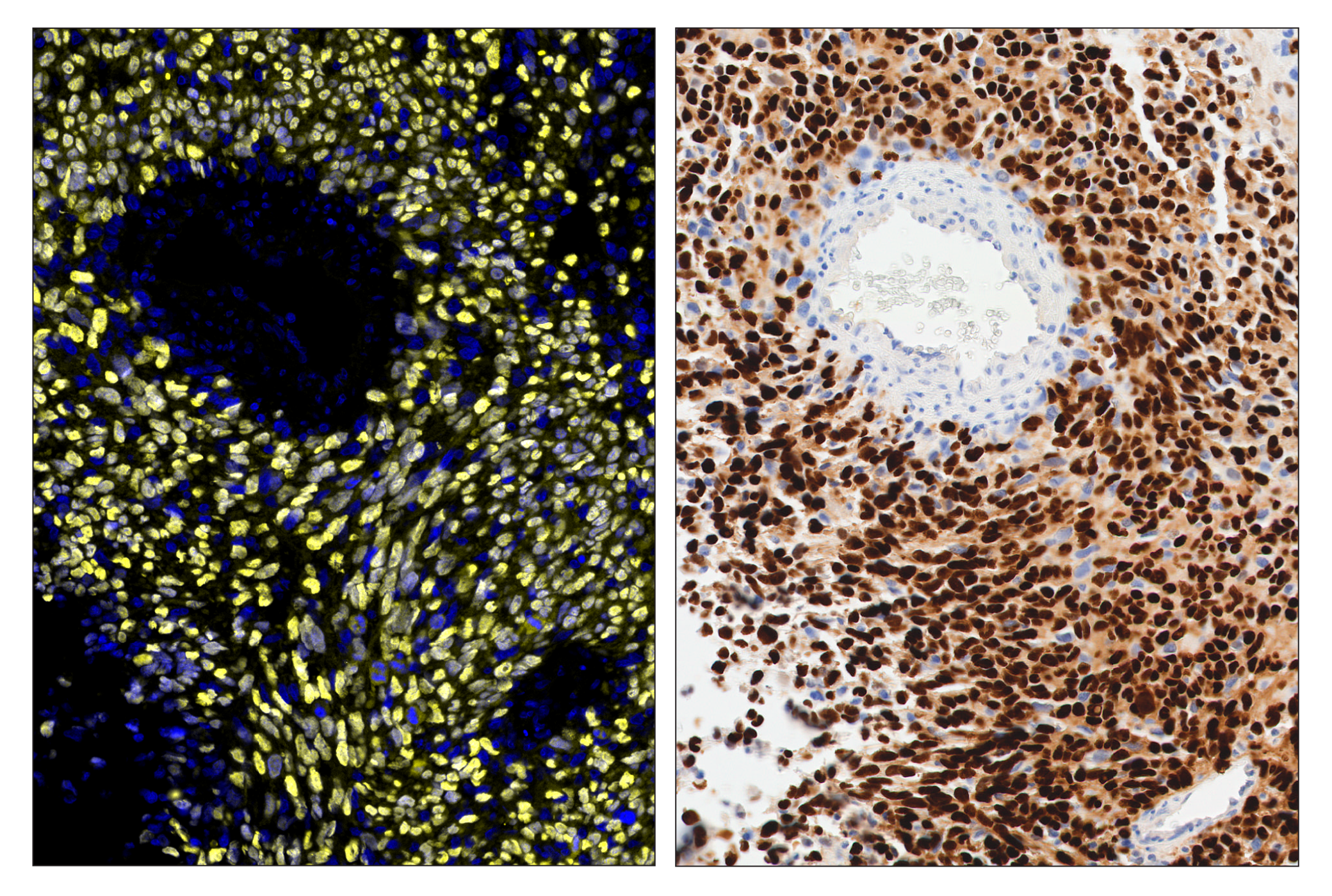 Immunohistochemistry Image 5: Sox10 (E6B6I) & CO-0080-594 SignalStar™ Oligo-Antibody Pair