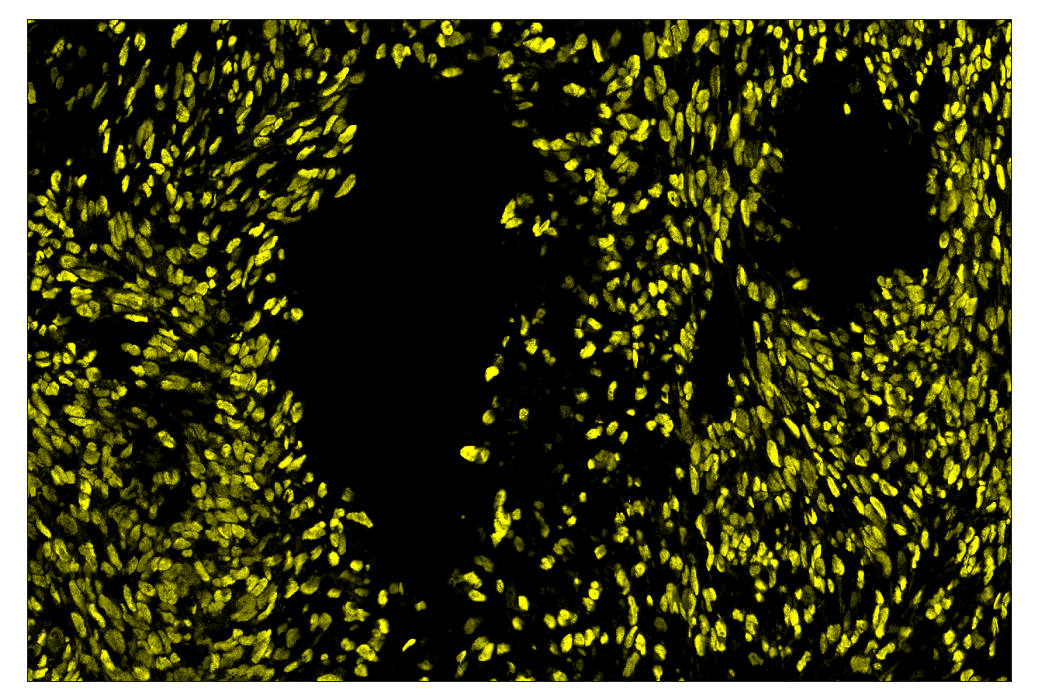 Immunohistochemistry Image 3: Sox10 (E6B6I) & CO-0080-647 SignalStar™ Oligo-Antibody Pair